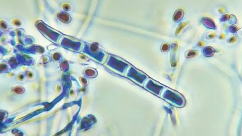 Laboratorio de Micologia