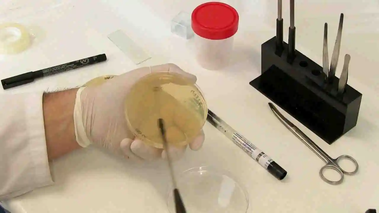 Sedimento Urinario + Urocultivo