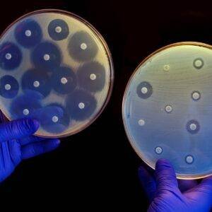 Mecanismo de Resistencia Bacteriana I y II