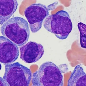 interpretacion de frotis